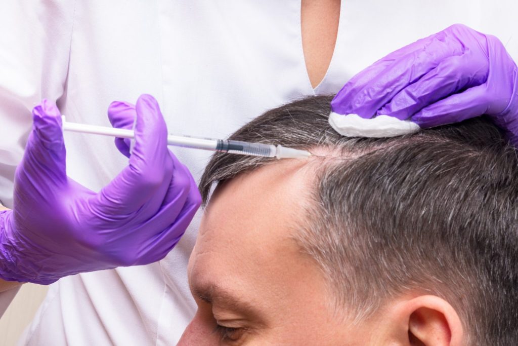 Next-Generation Platelet Treatments for Hair Restoration
